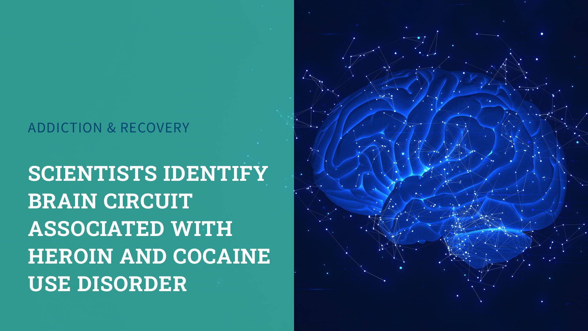 Research Report: Scientists Identify Brain Circuit Associated With Heroin and Cocaine Use Disorder 